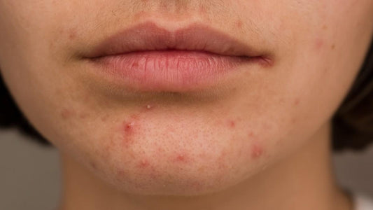 Product Overload: Has Your Skincare Routine Gone Too Far?